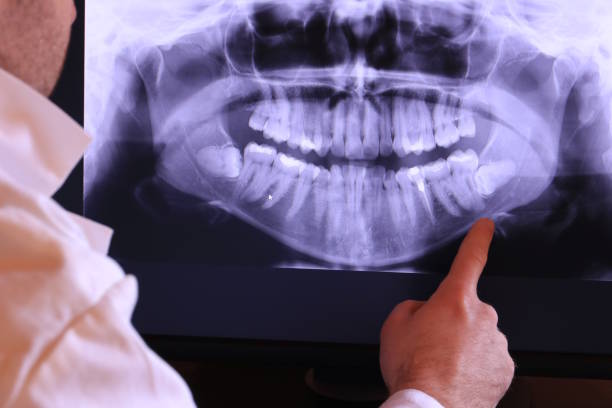 Best Emergency Dentist for Special Needs Patients in Lawrenceville, NJ